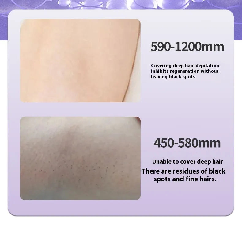 Painless IPL Hair Removal Device – Ice Cooling Technology™ | Safe & Effective At-Home Laser