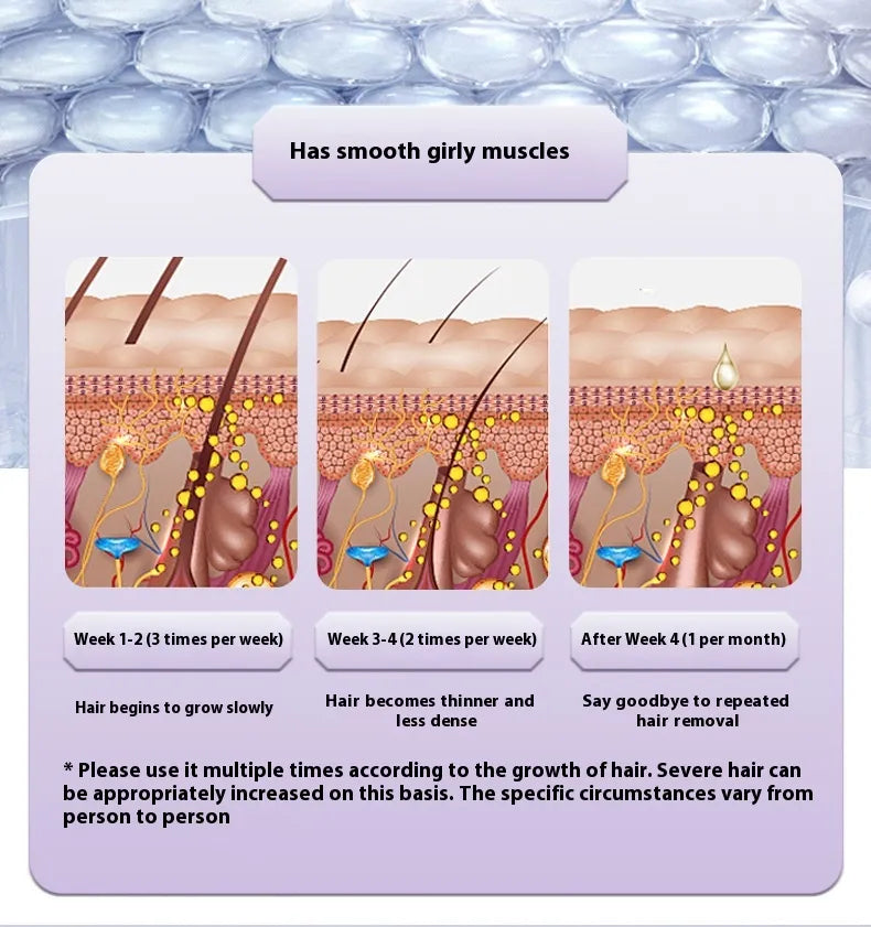 Painless IPL Hair Removal Device – Ice Cooling Technology™ | Safe & Effective At-Home Laser