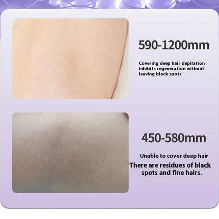 Painless IPL Hair Removal Device – Ice Cooling Technology™