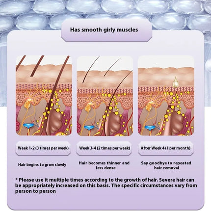 Painless IPL Hair Removal Device – Ice Cooling Technology™