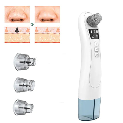 ClearSkin Ultrasonic Electric Blackhead Remover – Pore Cleaner & Acne Extractor