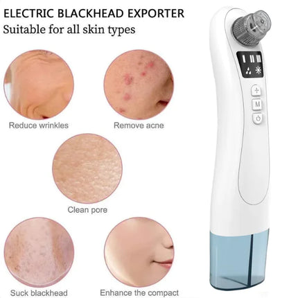 ClearSkin Ultrasonic Electric Blackhead Remover – Pore Cleaner & Acne Extractor